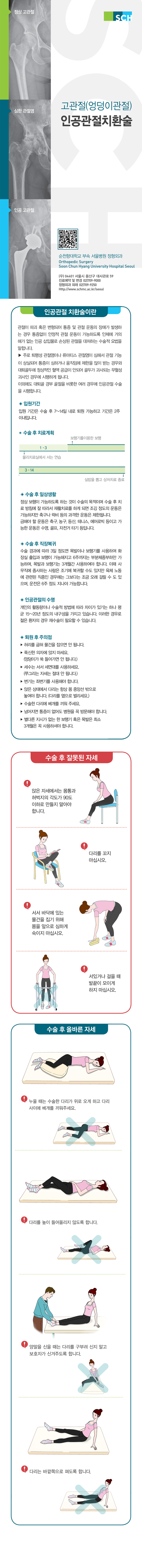 정상 고관절 SCH 심한 관절염 고관절(엉덩이관절) 인공관절치환술 인공고관절 마미 순천향대학교 부속 서울병원 정형외과 Orthopedic Surgery Soon Chun Hyang University Hospital Seoul (우 04401 서울시 용산구 대사관로 59 진료예약 및 변경 02)709-9000 정형외과 외래 02)709-9250 Http://www.schmc.ac.kr/seoul 인공관절 치환술이란 관절이 파괴 혹은 변형되어 통증 및 관절 운동의 장애가 발생하 는 경우 통증없이 안정적 관절 운동이 가능하도록 인체에 거의 해가 없는 인공 삽입물로 손상된 관절을 대처하는 수술적 요법을 말합니다. ▶ 주로 퇴행성 관절염이나 류마티스 관절염이 심해서 관절 기능 이 상실되어 통증이 심하거나 움직임에 제한을 많이 받는 경우와 대퇴골두에 정상적인 혈액 공급이 안되어 골두가 괴사되는 무혈성 괴사인 경우에 시행하게 됩니다. 이외에도 대퇴골 경부 골절을 비롯한 여러 경우에 인공관절 수술 을 시행합니다. ◆ 입원기간 입원 기간은 수술 후 7~14일 내로 퇴원 가능하고 기간은 2주 이내입니다. • 수술 후 치료계획 보행기를이용한 보행 1-3 물리치료실에서 서는 연습 3-14 실밥을 뽑고 상처치료 종료 수술 후 일상생활 정상 보행이 가능하도록 하는 것이 수술의 목적이며 수술 후 치 료 방침에 잘 따라서 재활치료를 하게 되면 조깅 정도의 운동은 가능하지만 축구나 럭비 등의 과격한 운동은 제한됩니다. 금해야 할 운동은 축구 농구 등산, 테니스, 에어로빅 등이고 가 능한 운동은 수영, 골프, 자전거 타기 등입니다. ◆ 수술 후 직장복귀 수술 경과에 따라 3일 정도면 목발이나 보행기를 사용하여 화 장실 출입과 보행이 가능해지고 6주까지는 부분체중부하만 가 능하며, 목발과 보행기는 3개월간 사용하여야 합니다. 이때 사 무직에 종사하는 사람은 조기에 복귀할 수도 있지만 육체 노동 에 관련된 직종인 경우에는 그보다는 조금 오래 걸릴 수 도 있 으며, 운전은 6주 정도 지나야 가능합니다. ◆ 인공관절의 수명 개인의 활동량이나 수술적 방법에 따라 차이가 있기는 하나 평 균 15~20년 정도의 내구성을 가지고 있습니다. 이러한 경우로 젊은 환자의 경우 재수술이 필요할 수 있습니다. 퇴원 후 주의점 ▶ 허리를 굽혀 물건을 잡으면 안 됩니다. ► 푹신한 의자에 앉지 마세요. (엉덩이가 쑥 들어가면 안 됩니다.) ▶ 세수는 서서 세면대를 사용하세요. (쭈그리는 자세는 절대 안 됩니다.) ▶ 변기는 좌변기를 사용해야 합니다. ▶ 앉은 상태에서 다리는 항상 몸 중앙선 밖으로 놓여야 합니다. (다리를 옆으로 벌리세요.) ▶ 수술한 다리에 베개를 끼워 주세요. ▶ 넘어지면 통증이 없어도 병원을 꼭 방문해야 합니다. ▶ 별다른 지시가 없는 한 보행기 혹은 목발은 최소 3개월은 꼭 사용하셔야 합니다. 수술 후 잘못된 자세 앉은 자세에서는 몸통과 허벅지의 각도가 90도 이하로 만들지 말아야 합니다. 다리를 꼬지 마십시오. 서서 바닥에 있는 물건을 집기 위해 몸을 앞으로 심하게 숙이지 마십시오. 서있거나 걸을 때 발끝이 모이게 하지 마십시오. 수술 후 올바른 자세 - 누울 때는 수술한 다리가 위로 오게 하고 다리사이에 베개를 끼워주세요.- 다리를 높이 들어올리지 않도록 합니다.양말을 신을 때는 다리를 구부려 신지 말고 보호자가 신겨주도록 합니다. 다리는 바깥쪽으로 펴도록 합니다.