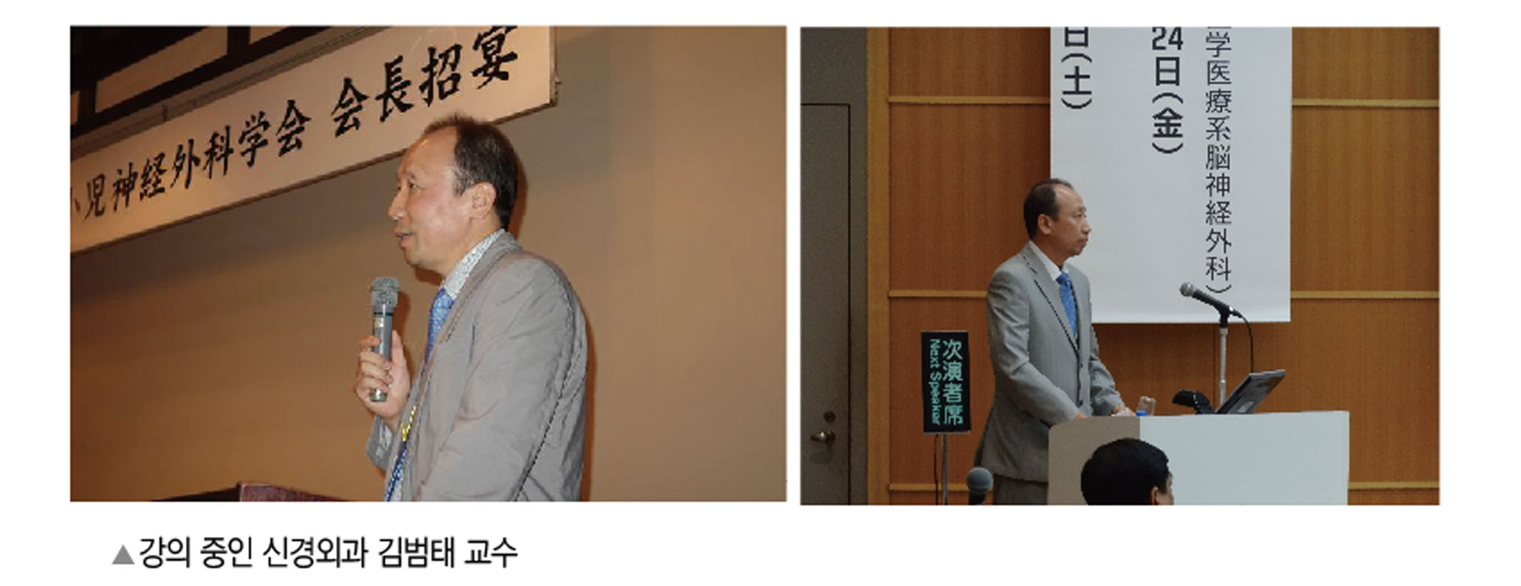 뇌혈관조영술
