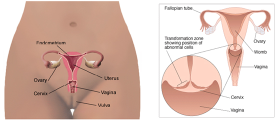 cervix-자궁경부 uterus-자궁체부(내막) ovary(난소) 사진