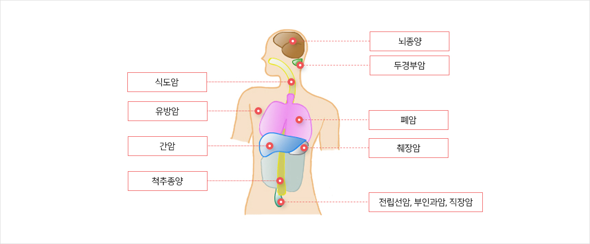 순천향대학교천안병원 치료대상질환